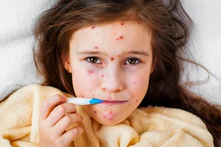 Czechia registers first measles outbreak after two-year absence