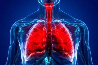Czech health officials urge calm amid rise in dry pneumonia cases