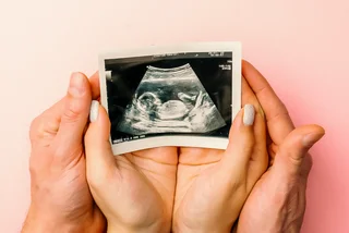 Czechia moves to make egg donations safer for women